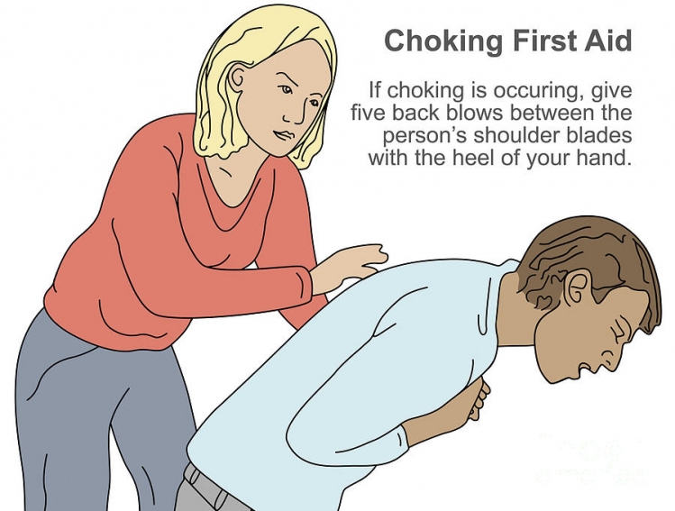 Choking: First aid